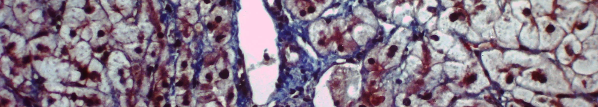 Interferon-stimulated gene expression in chronic hepatitis C virus genotype 1 infected patients treated with the NS3/4A protease inhibitor faldaprevir in combination with pegylated interferon alpha-2a/ribavirin