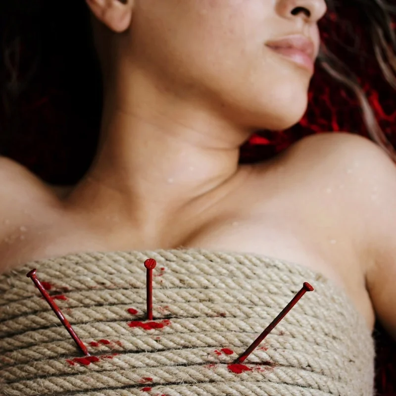 Vascular trauma and lactate clearance as predictor determining mortality. Case report.
