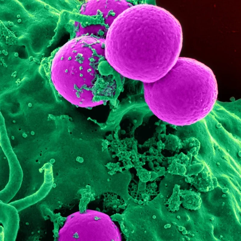 Optimization of long-term Breast Cancer Cell Culture using live Imaging in an automated Perfusion System