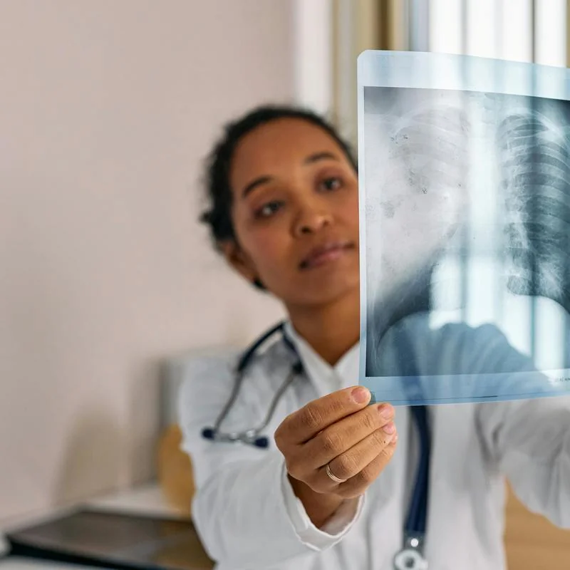 Pulmonary Cystic adenomatoid malformation type 2: first case report in Floridablanca, Santander, Colombia